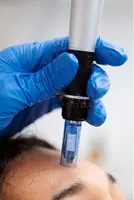 Best PRP Treatment in Abu Dhabi