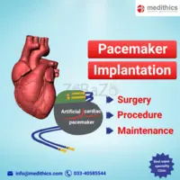 Pacemaker of the heart in kolkata