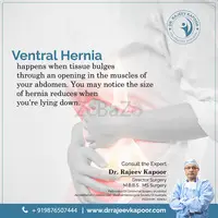 Best Hernia Surgeon in Chandigarh - 1