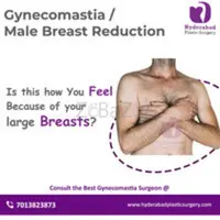 Best Gynecomastia Surgery in Hyderabad - 2