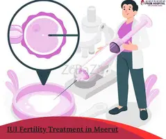 IUI Fertility Treatment in Meerut - 1