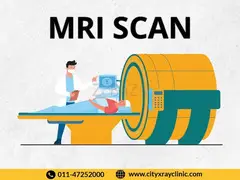 MRI Scan Near Me At Best Price In Tilak Nagar - 1