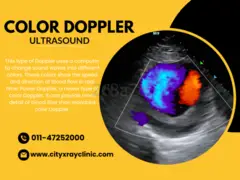 Best & Affordable Diagnostic Centre For Color Doppler Near Me In Delhi - 1