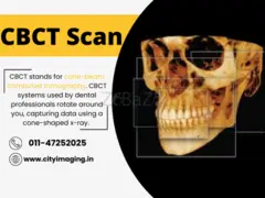Best & Affordable CBCT Scan Near me In Delhi