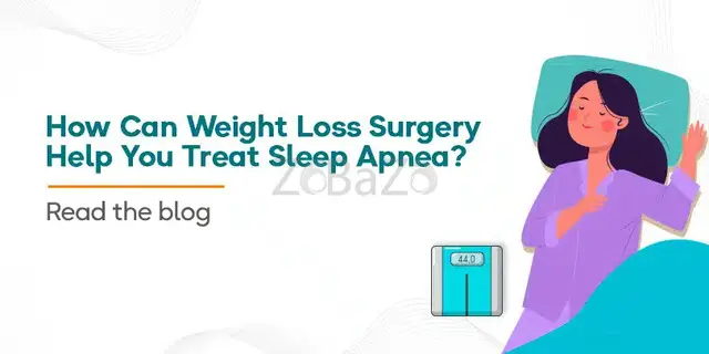 How Can Weight Loss Surgery Help You Treat Sleep Apnea? - 1