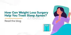 How Can Weight Loss Surgery Help You Treat Sleep Apnea?