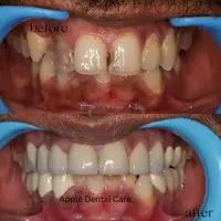 Apple Dental Care Vellalore