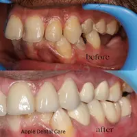 Apple Dental Care Vellalore