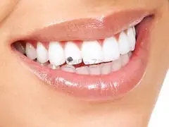 Apple Dental Care Vellalore