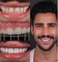 Best Dentist Coimbatore