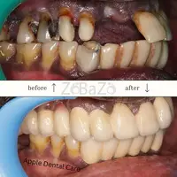 Best Dentist Coimbatore