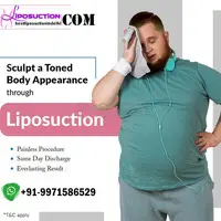 Liposuction Surgery in Delhi - 1