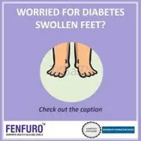 Exploring the Link Between Diabetes and Swollen Feet