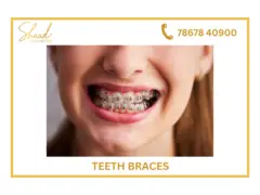 Tooth implants in coimbatore | dental implants