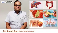 Dr. Neeraj Goel is the best Cancer Surgeon in Delhi