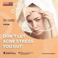 best pulsed dye laser treatment in india