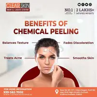 Birthmark removal treatment in india