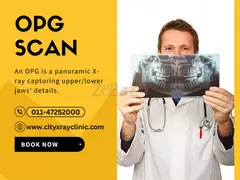 OPG X-Ray Cost Guide Know the Price Before You Book