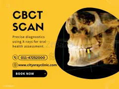 CBCT Scan Price What to Expect Before Your Visit