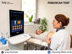 FibroScan Test Price: What to Expect & Save Money