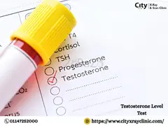 Affordable Testosterone Level Test Price Guide