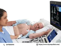 2D Echo Test Price What You Should Expect to Pay
