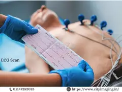 ECG Test Price What It Costs & What to Expect