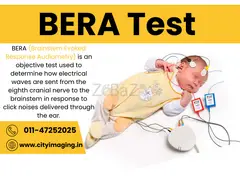 Know the Latest BERA Test Price Near You Book Today