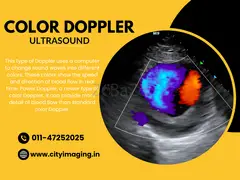 Know Colour Doppler Test Price Near You Today