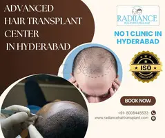 Advanced Hair Transplant Center in Hyderabad
