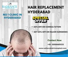 Affordable Hair Replacement Services in Hyderabad
