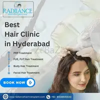 Top-Rated Hair Transplant Clinics in Hyderabad