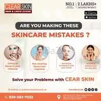best Vitiligo Treatments in india