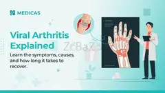 What Is Viral Arthritis? Everything You Need to Know