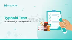Typhoid Test Guide: How to Read Your Report Correctly
