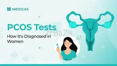 From Symptoms to Diagnosis: Tests That Reveal PCOS