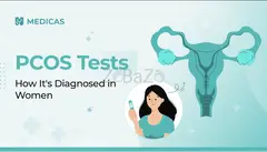 PCOS Diagnosis Made Simple: Key Tests Explained