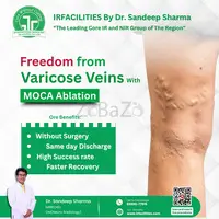 Find the Best Varicose Veins Doctor in India: Expert Care for Healthy Legs