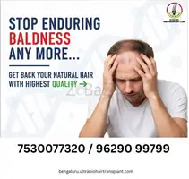 Hair transplant in Bengaluru