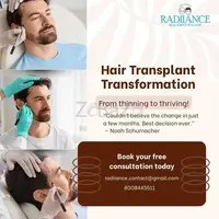 Professional Hair Replacement Solutions in Hyderabad