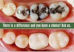 Dental Fillings Clinic Near Sector 15 Noida - Call us 8377990994