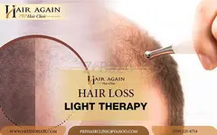 laser hair therapy fresno