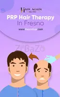 Plasma Rich Platelet Therapy For Hair Loss Fresno - 1