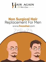 Best Non Surgical Hair Replacement - 1