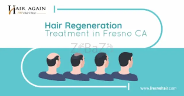 Hair Regeneration Treatment in Fresno - 1