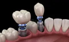 McClane Dentistry - 4