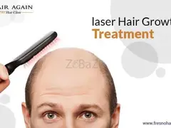 Laser Hair Replacement Therapy - 1