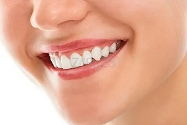 The Colony Teeth Whitening - 1