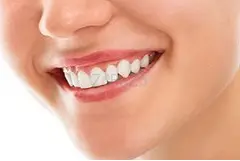 The Colony Teeth Whitening - 1