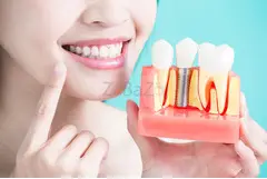 orthodontic treatment near me Duluth, GA